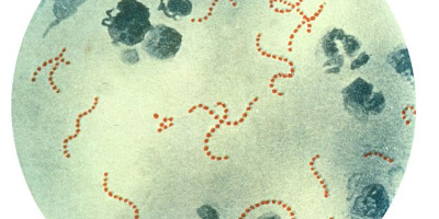 Mikrobiologi och bioteknik