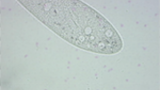 Paramecium caudatum: Kontraktil vakuol