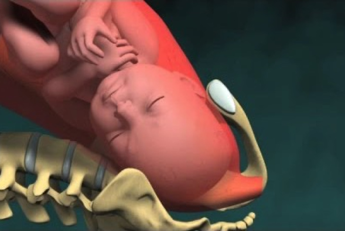 3D-animering av förlossning