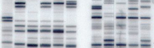 DNA fingerprinting