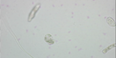 Flagellater under mikroskopet