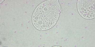 Tetrahymena thermophila