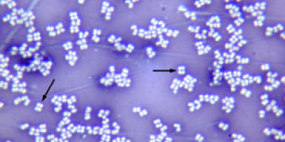 Prov 2011-03-28 i Bakteriologi och mikrobiologins historia