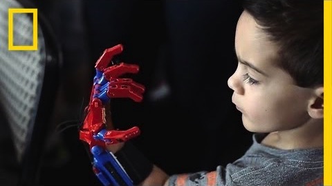 3D-printade proteser ändrar barnens liv