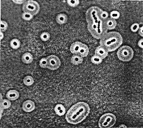 Kapsel hos Streptococcus mutans. 